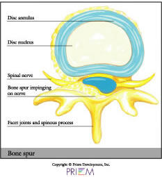 home remedies for back pain South Shore, home remedies for neck pain South Shore, home remedies for back pain Boston, home remedies for neck pain Boston, nonsurgical treatment for back pain south shore, nonsurgical treatment for neck pain south shore, nonsurgical treatment for back pain Boston, nonsurgical treatment for neck pain Boston, spine anatomy library south shore, spine anatomy library boston